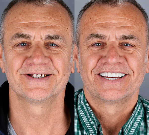 Resultado real — Jorge, 58, Rosario