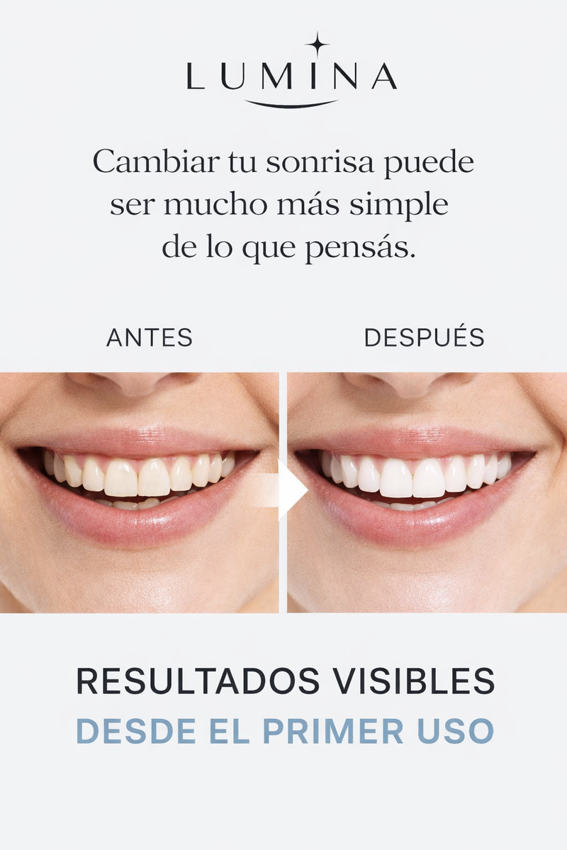 Lumina - Carillas Dentales Adaptables - imagen 6