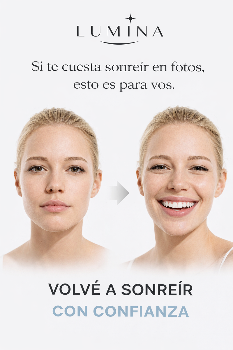 Lumina - Carillas Dentales Adaptables - imagen 7